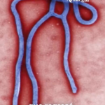 FRANCIA ACTIVA PROTOCOLOS SANITARIOS TRAS DETECTAR SU PRIMER CASO DE ÉBOLA