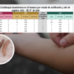 CON EL REPORTADO EN LOS ÚLTIMOS 7 DÍAS, VAN 12 CASOS DE GUSANO BARRENADOR EN HUMANOS